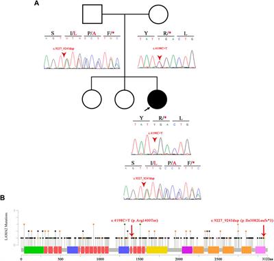 Frontiers Case Report Novel Frameshift Mutation In Lama Gene